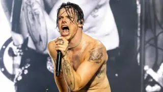Yungblud счупи крака си при инцидент с мотоциклет, но ще продължи концертните си изяви